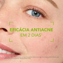 Gel-Creme Antiacne e Anti-Marcas Bioderma Sébium Kerato+ – 30ml